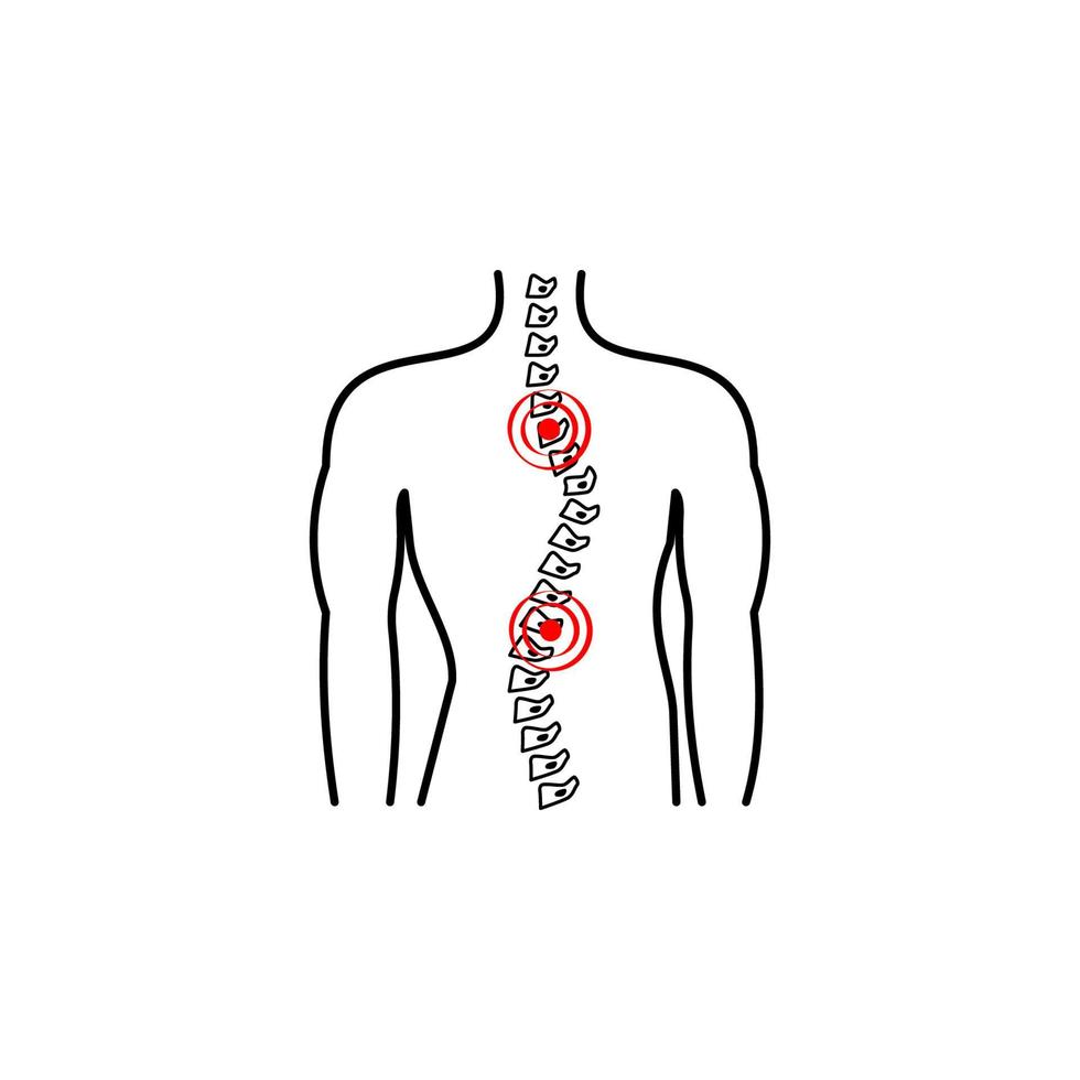 escoliosis, columna vertebral, dolor vector icono