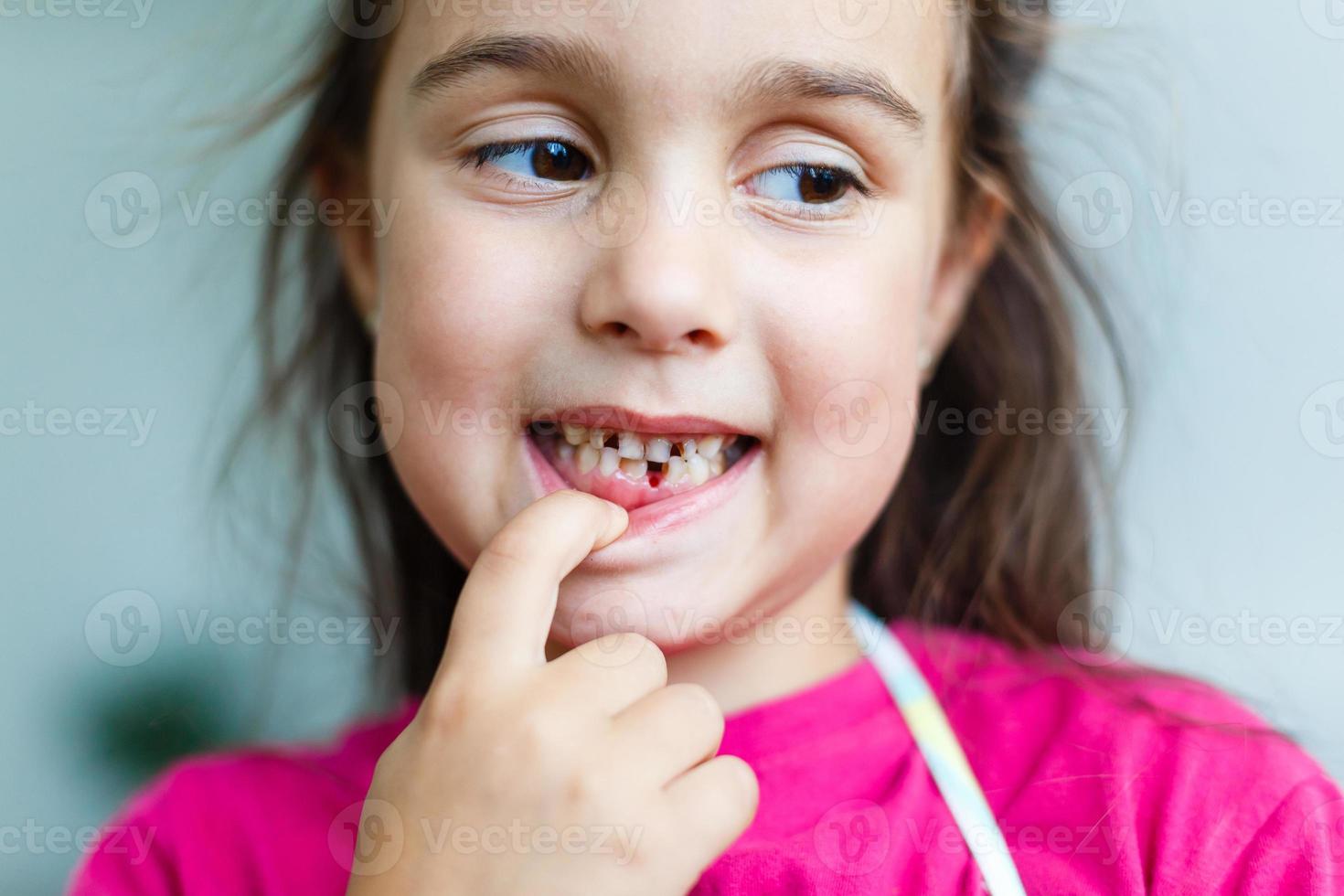 niño desaparecido algunos frente dientes. foto