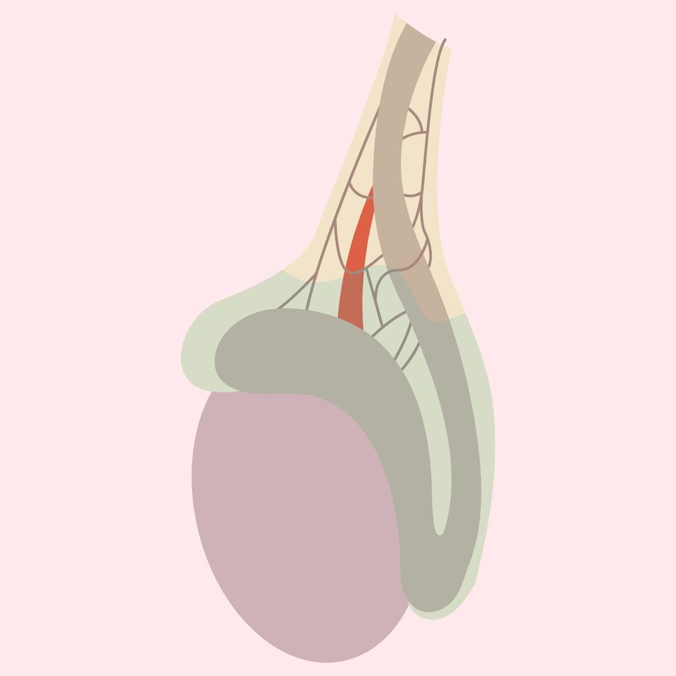 Illustration of a hydrocele, a common medical condition that affects the male reproductive system. Ideal for medical textbooks or websites. vector