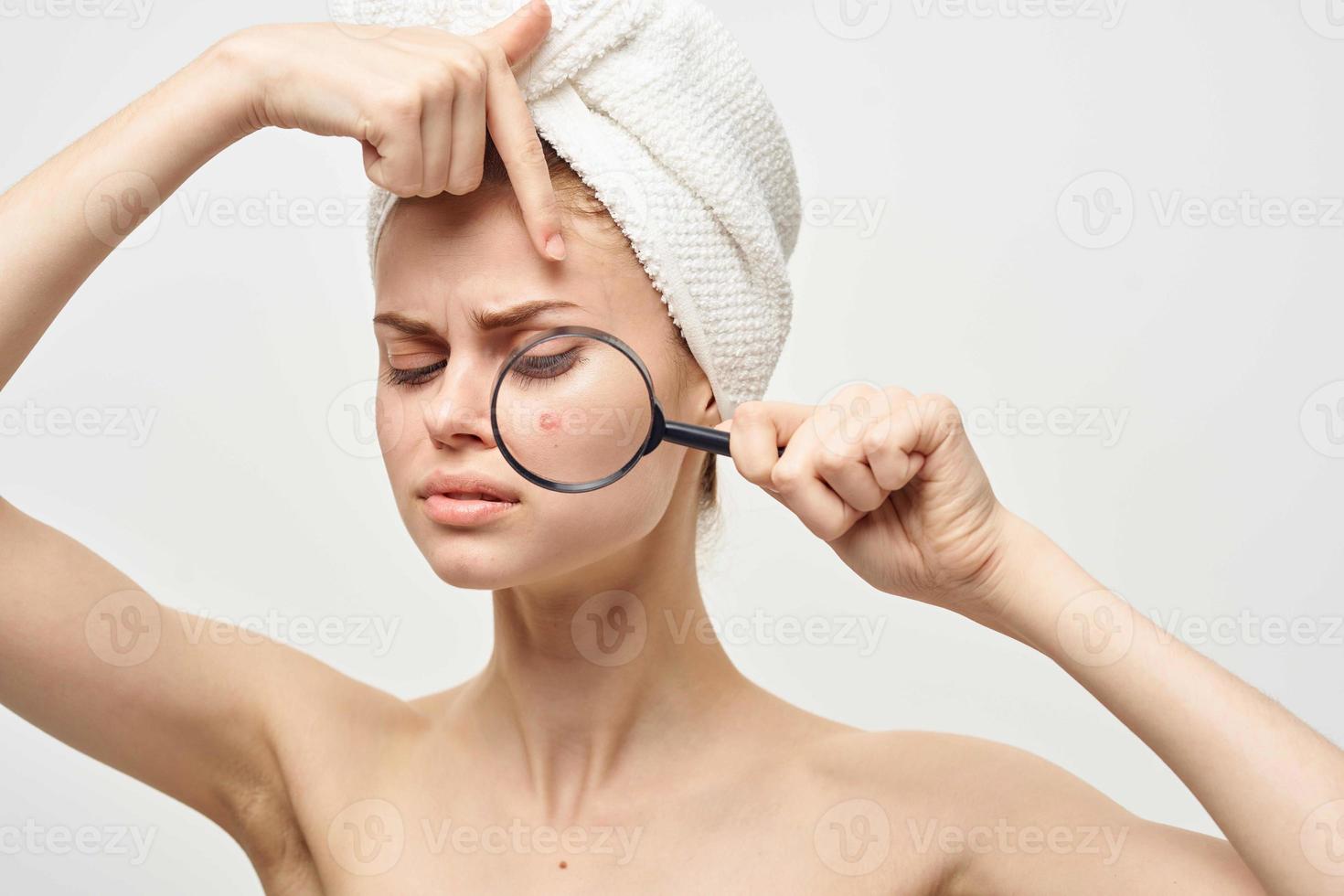 beautiful woman with a pimple on the face hygiene treatment photo