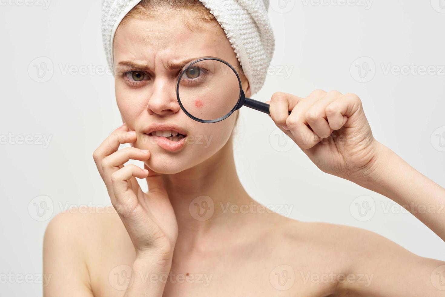 beautiful woman with a pimple on the face hygiene treatment photo
