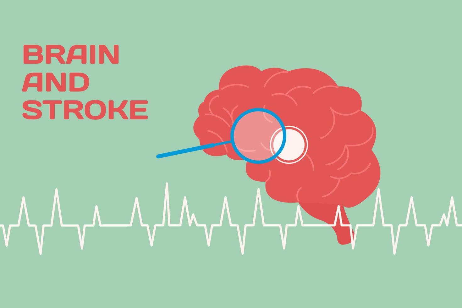Brain and stroke concept in flat style vector