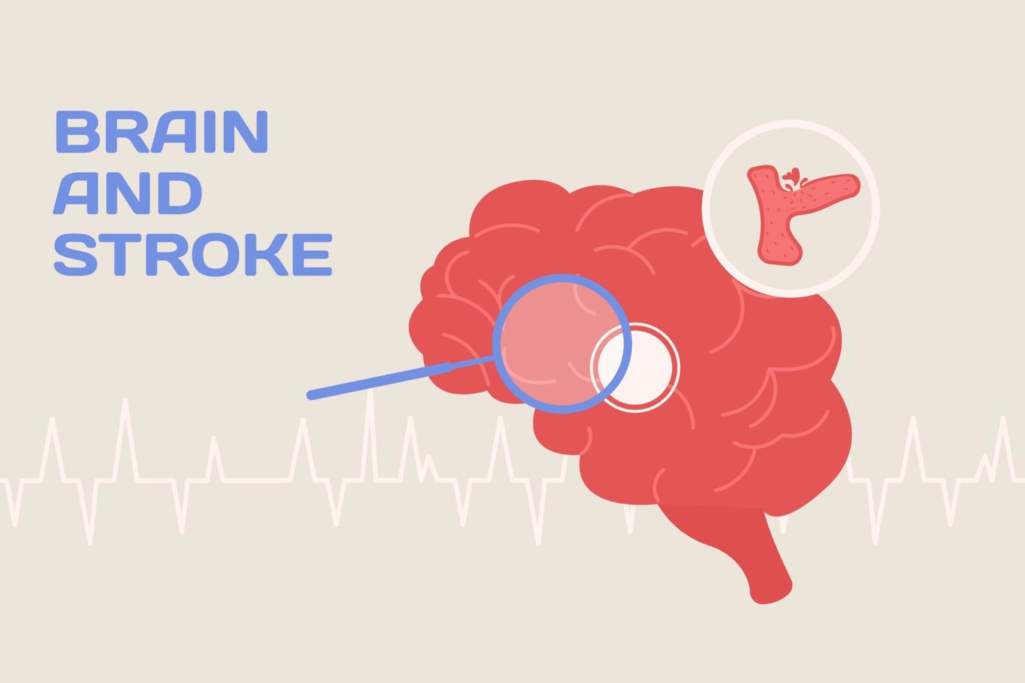 Brain and stroke concept illustration and poster in flat style vector