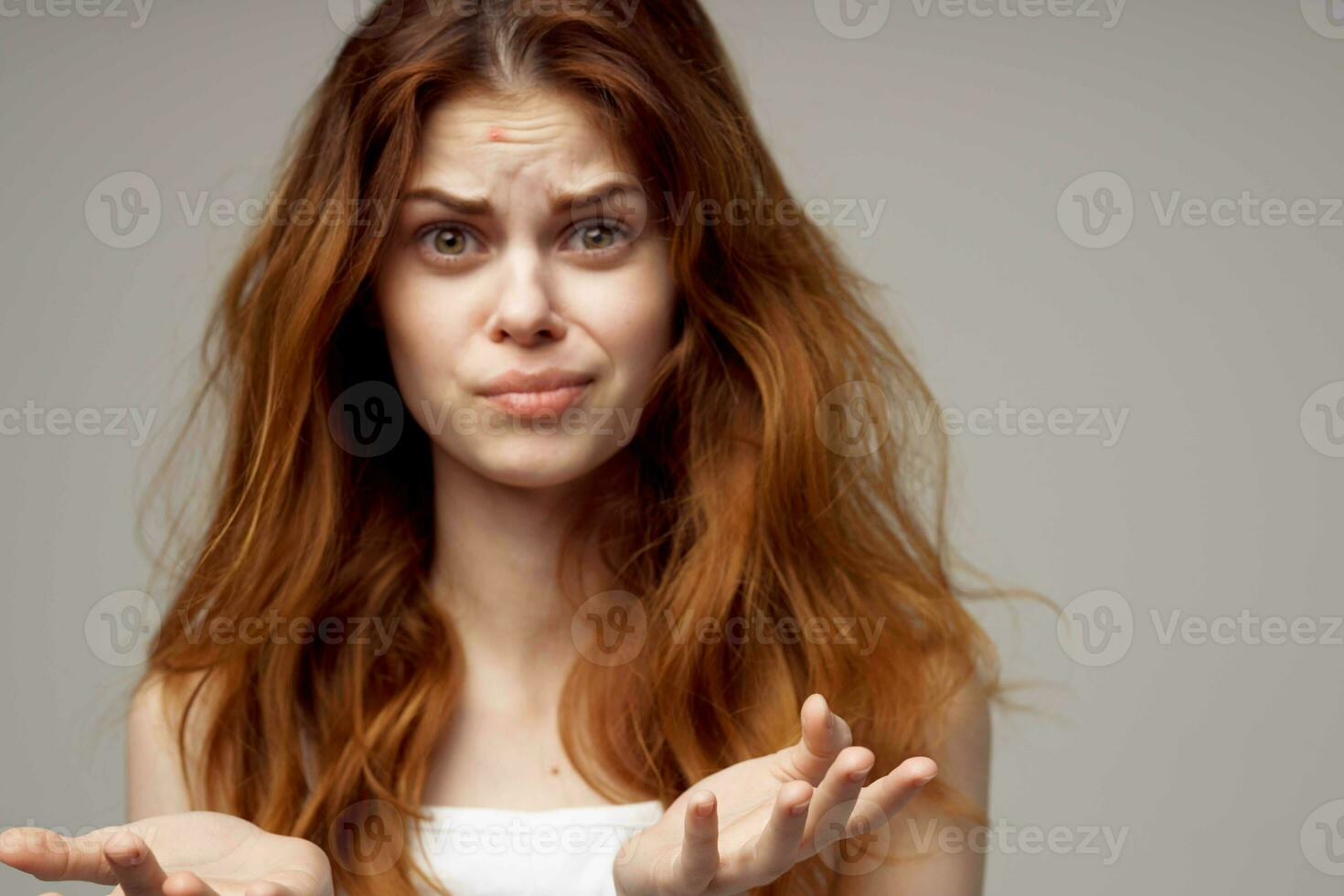 beautiful woman in a white t-shirt pimples on the face light background photo