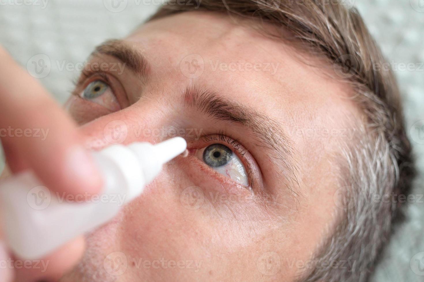 Man drops eye drops install lenses. photo