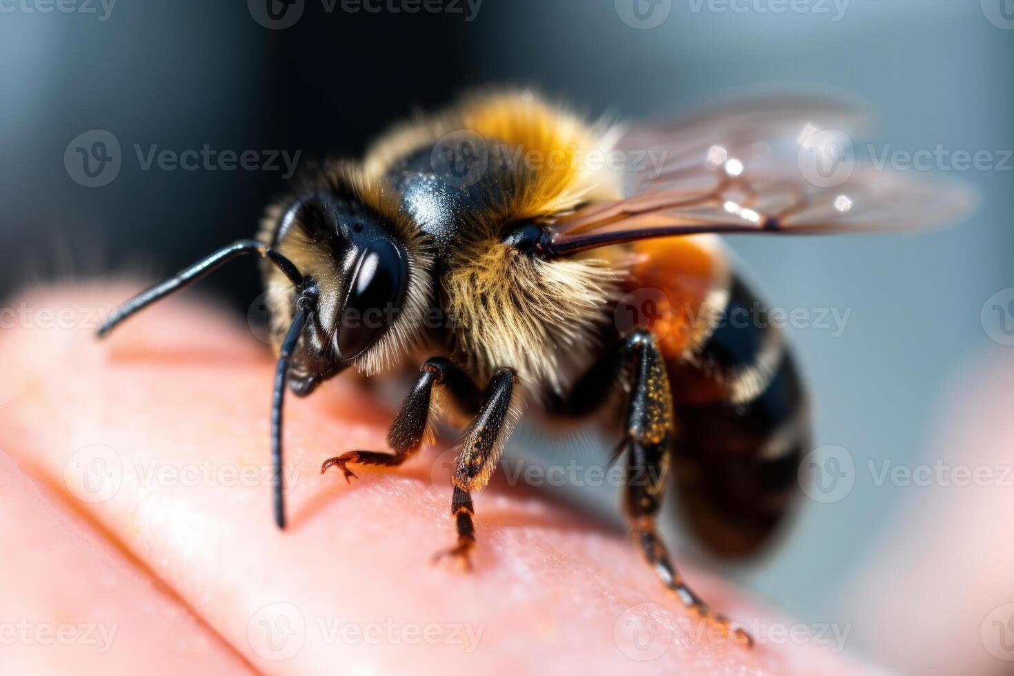 bee stung on the finger photo