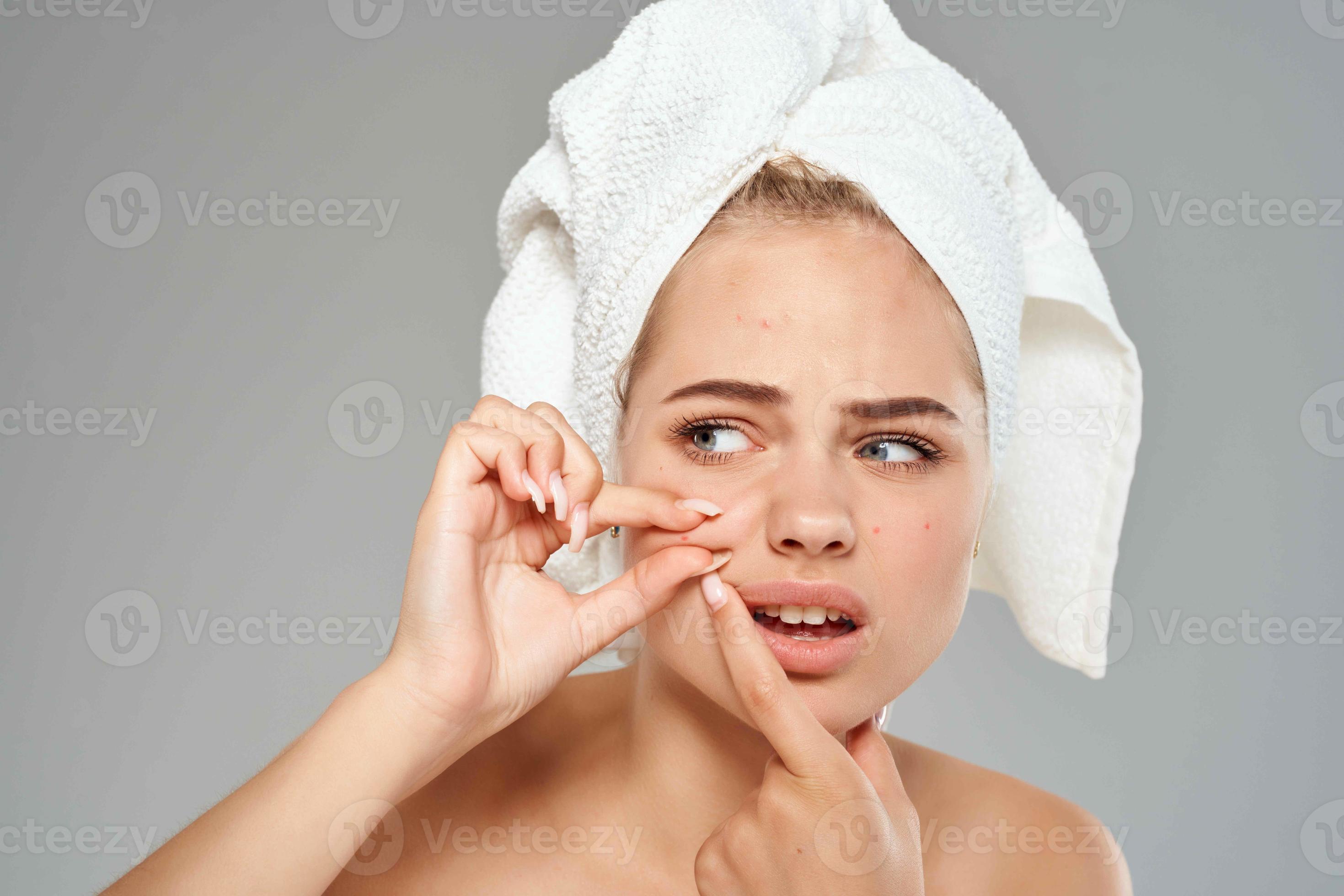 woman with a towel on her head acne on her face dermatology skin care