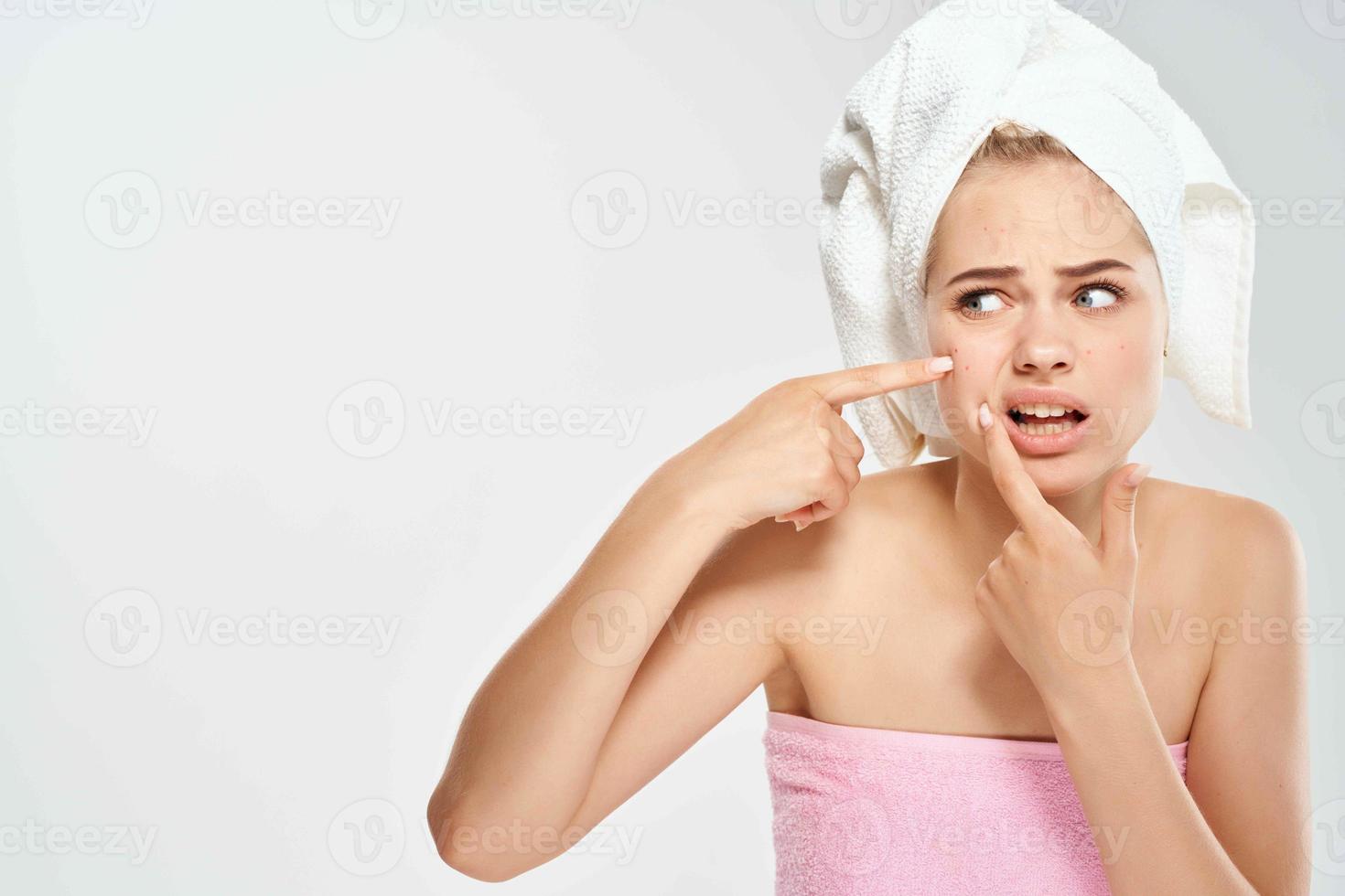 mujer con desnudo espalda apretones fuera espinillas en el cara dermatología acné foto