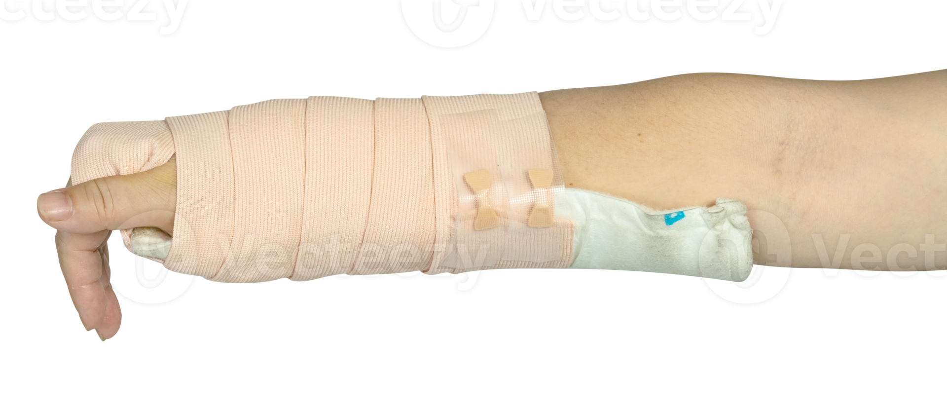 Hand making physical therapy to broken wrist from accident isolated png