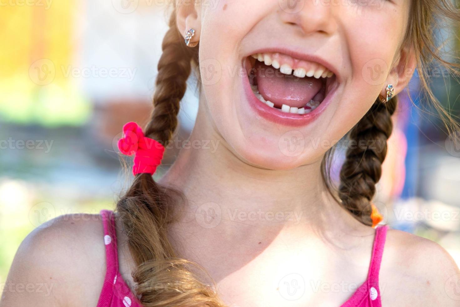 Toothless happy smile of a girl with a fallen lower milk tooth close-up. Changing teeth to molars in childhood photo