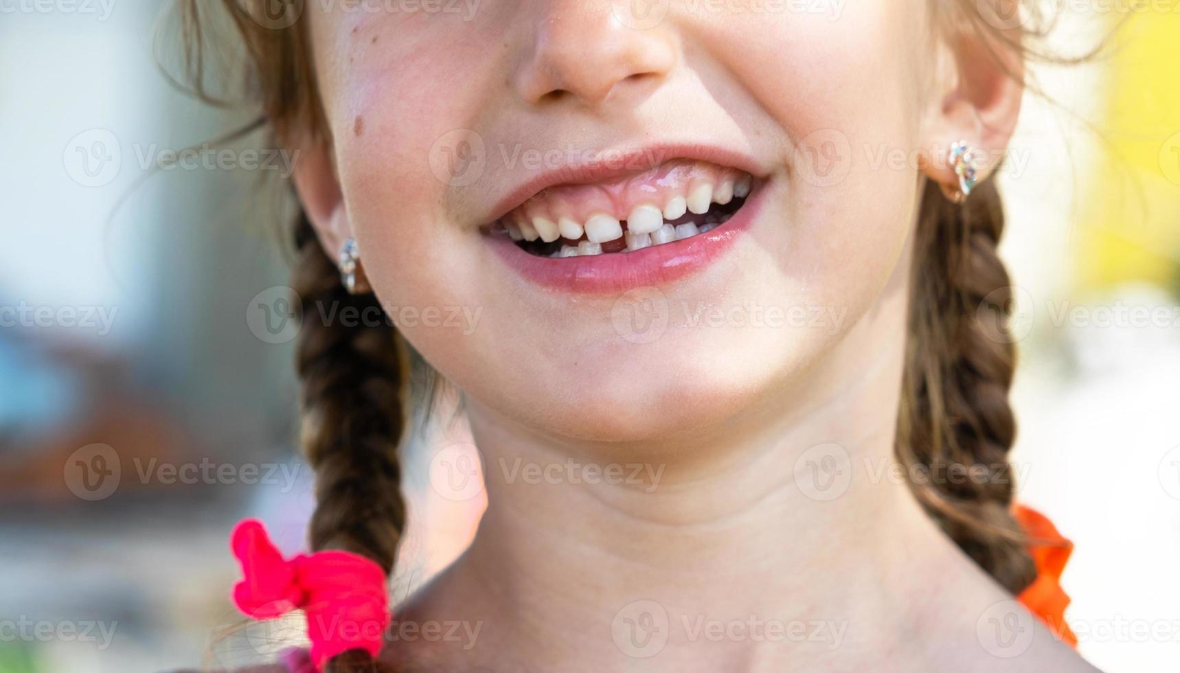 sin dientes contento sonrisa de un niña con un caído inferior Leche diente de cerca. cambiando dientes a molares en infancia foto