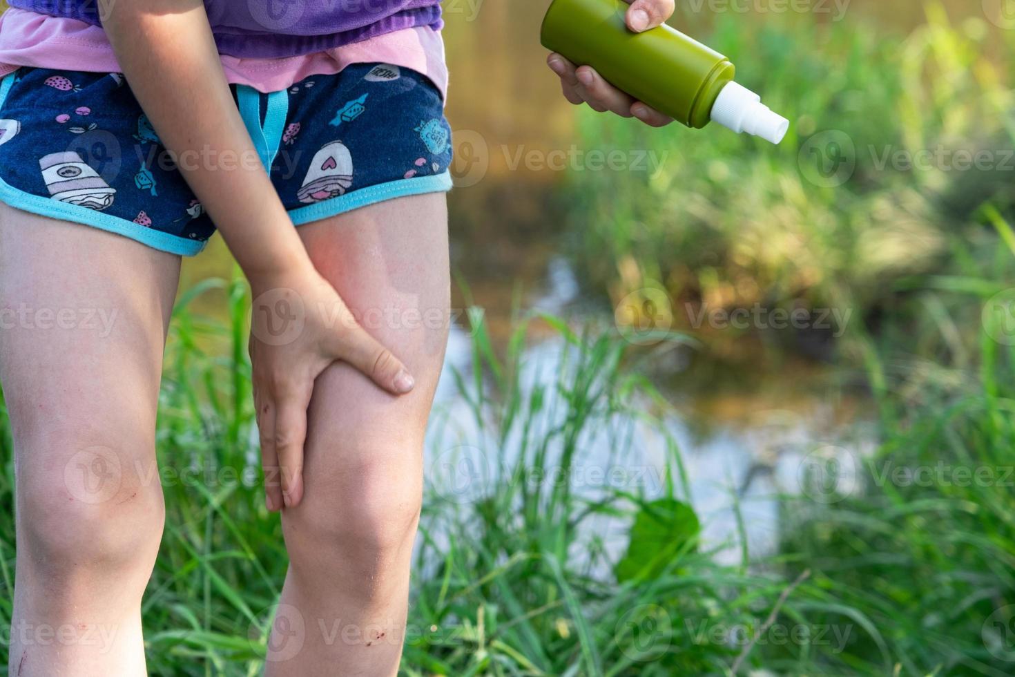Girl sprays mosquito spray on the skin in nature that bite her hands and feet. Protection from insect bites, repellent safe for children. Outdoor recreation, against allergies. Summer time photo
