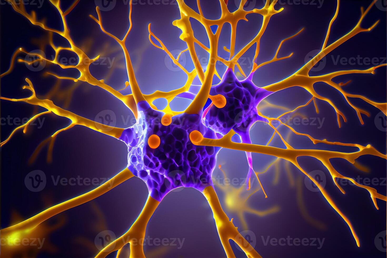 illustration of Nerve cells with Antibodies - Autoimmune disease photo
