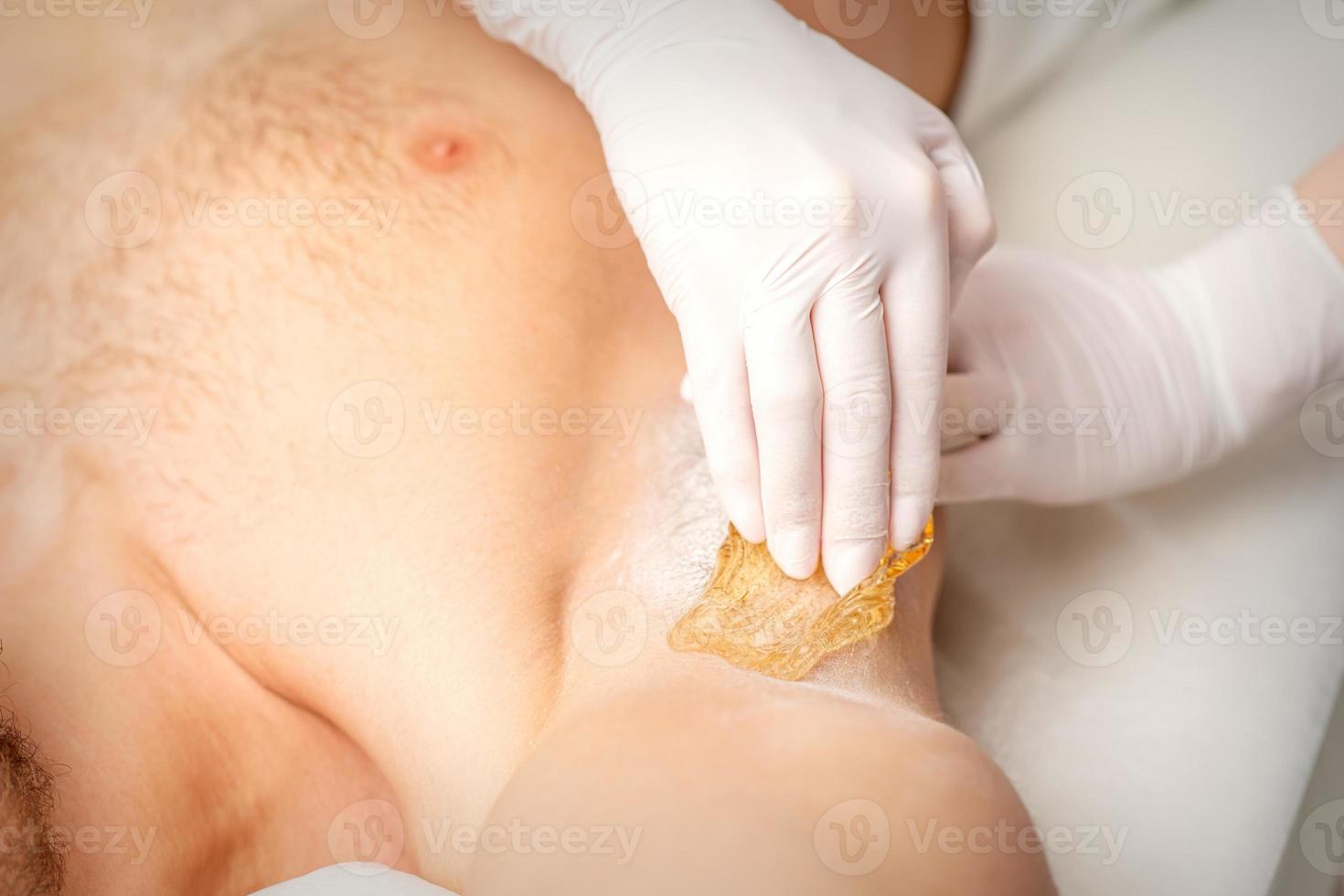 Young caucasian man receiving hair removal from his armpit in a beauty salon, depilation men's underarm. photo