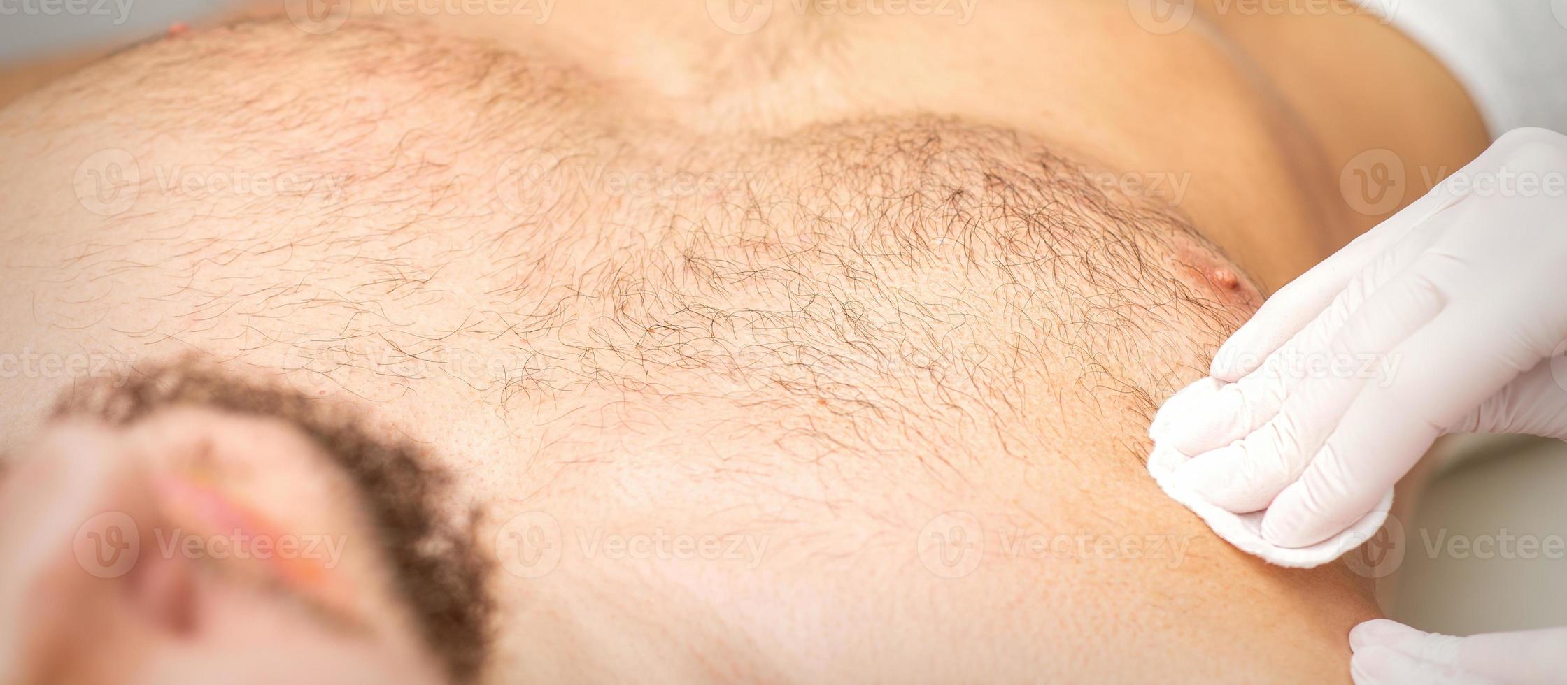 Young caucasian man receiving hair removal from his chest in a beauty salon, depilation men's torso. photo