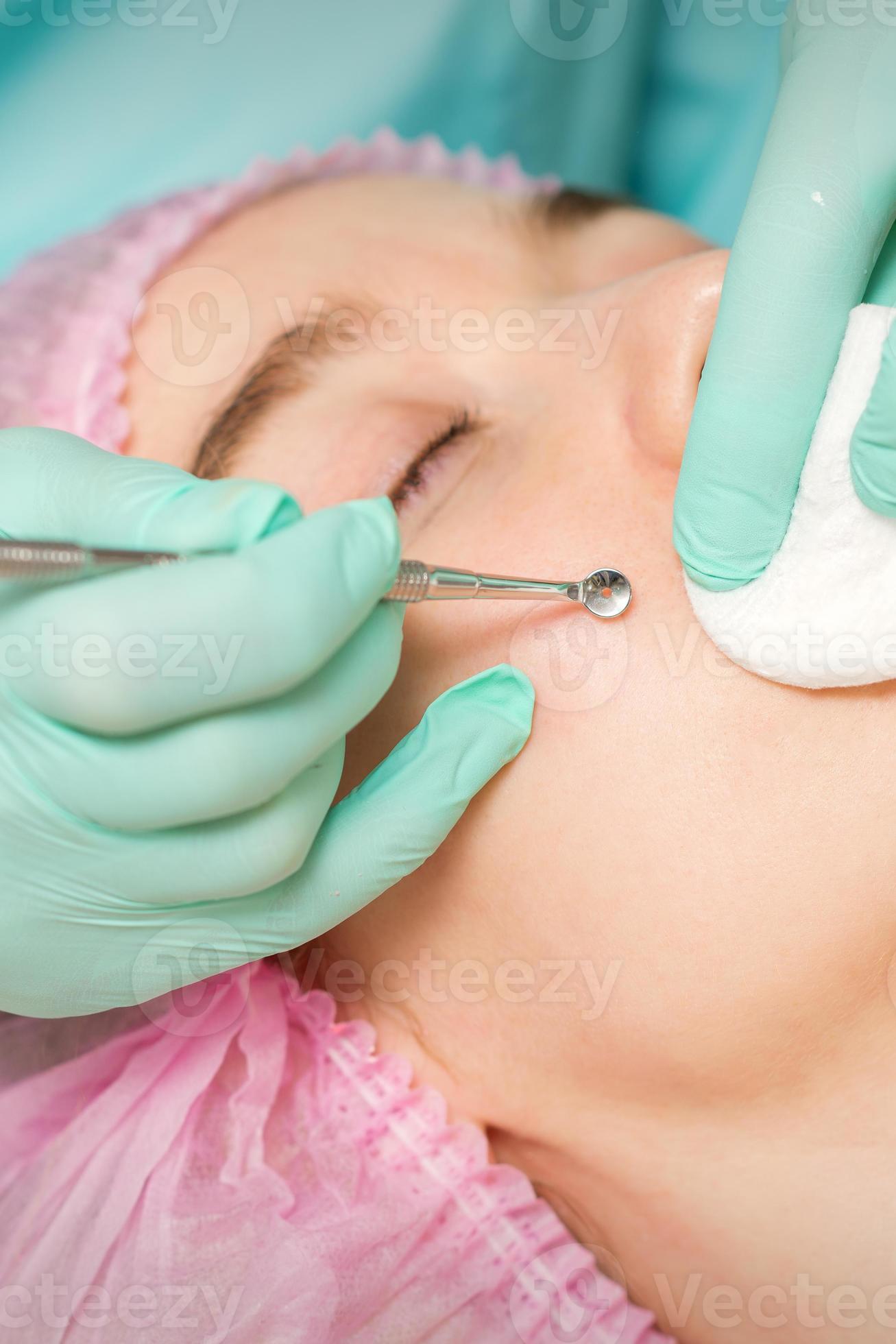 Huge Blackhead Removal Videos - hcbj00h