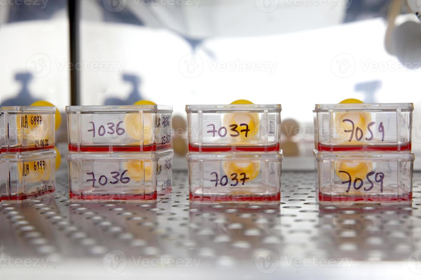 Cell culture flasks with blood samples in the incubator photo