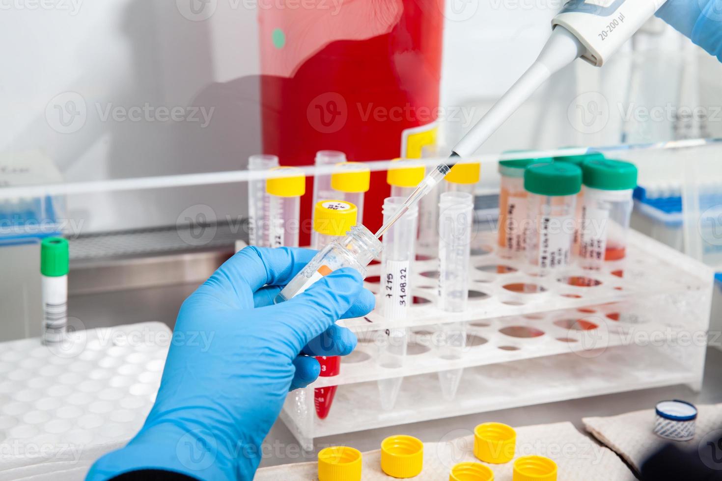 Scientist preparing blood samples for karyotipe and fluorescence in