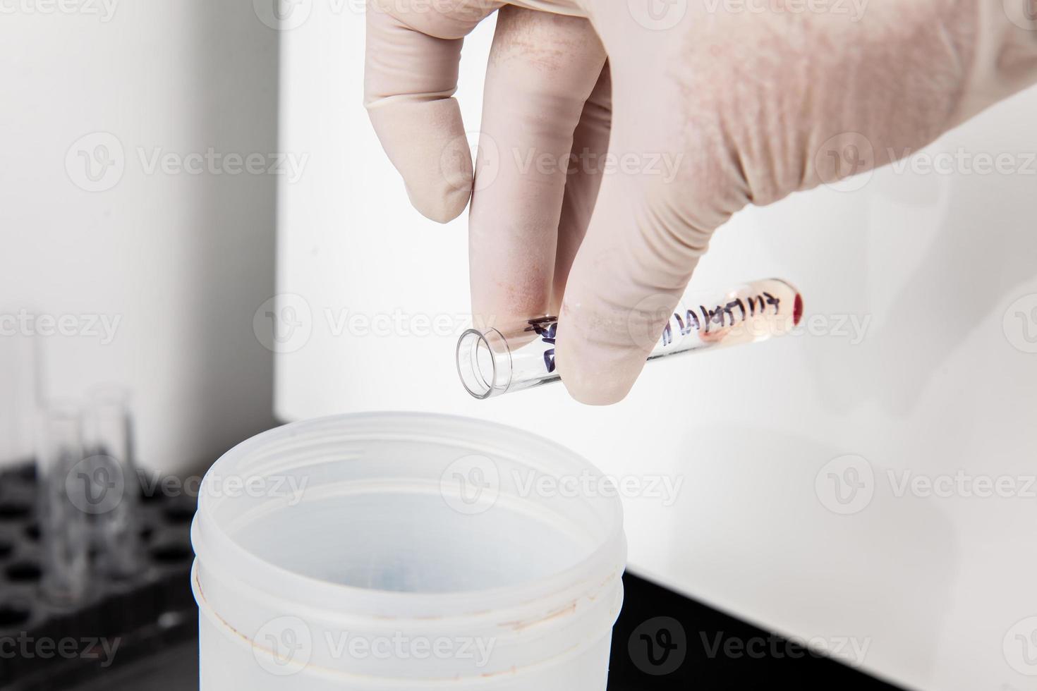 Scientist discarding the supernatant after centrifugation. Scientist preparing bone marrow samples for flow cytometric analysis in the laboratory. photo