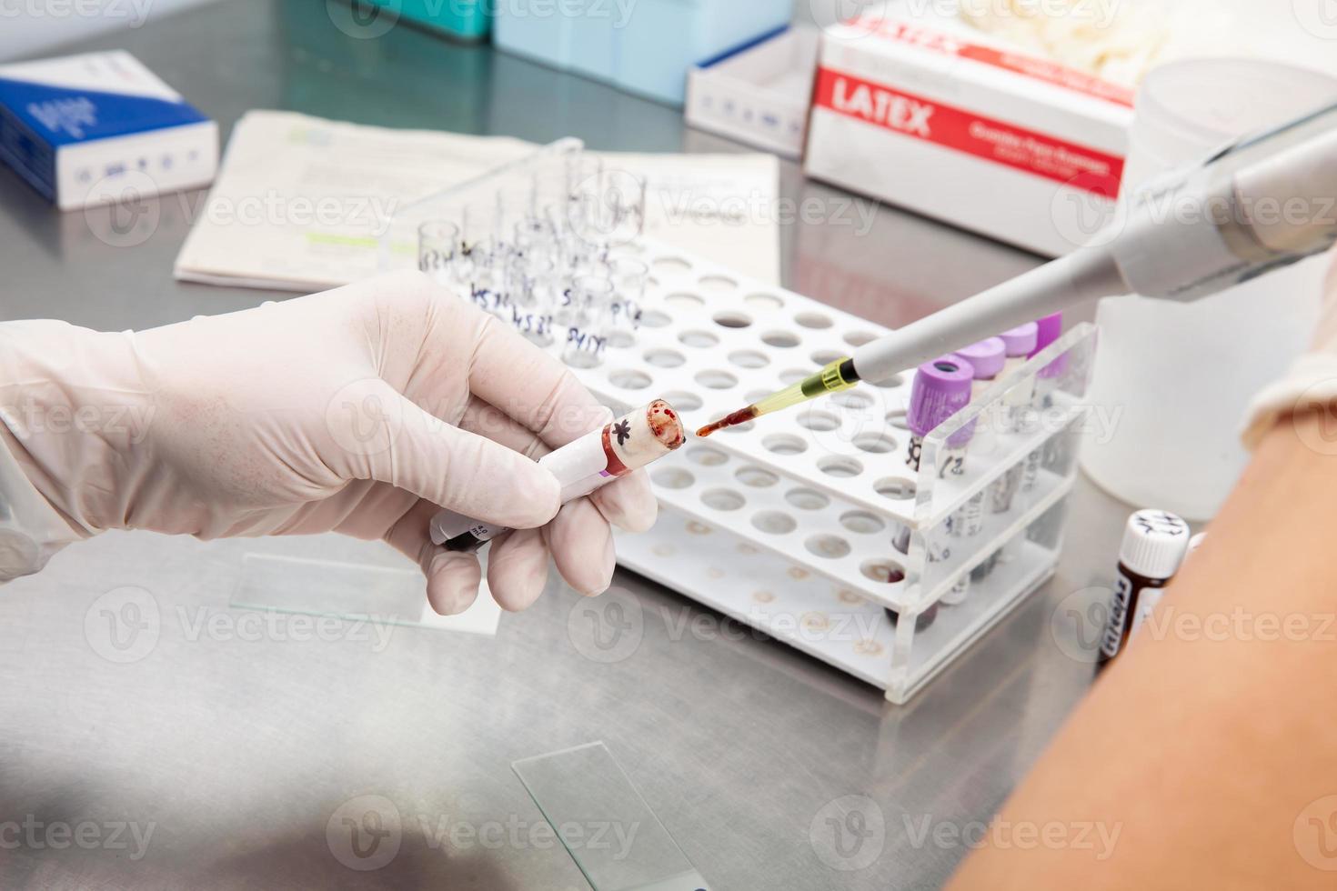 Scientist preparing samples for flow cytometric analysis in the laboratory. Cancer diagnosis photo