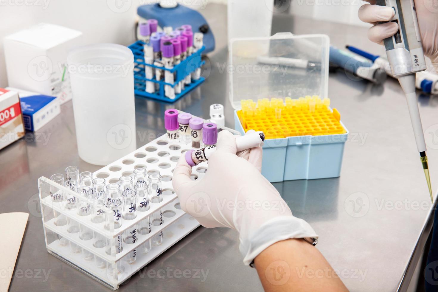 Scientist preparing bone marrow samples for flow cytometric analysis in the laboratory. photo