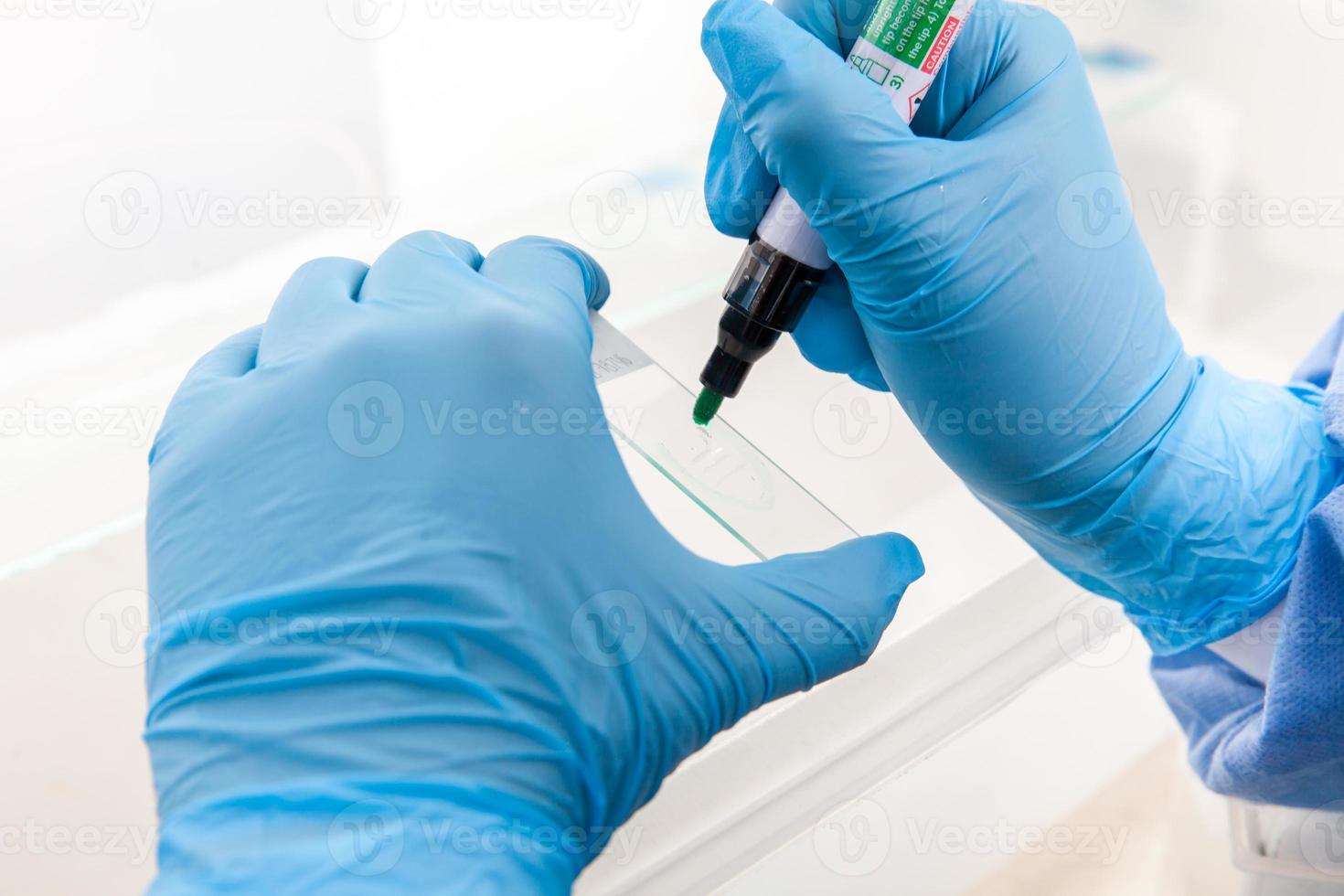 Scientist preparing slides with tissue samples for immunohistochemistry assay in the laboratory. photo
