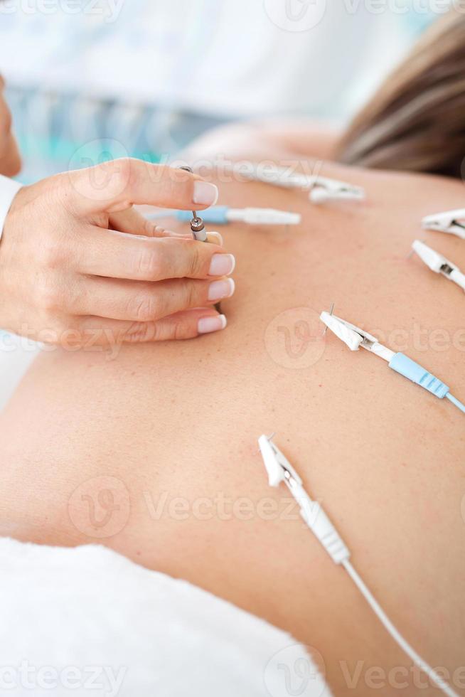 Doctor performing an electroacupuncture procedure on a female patient back photo