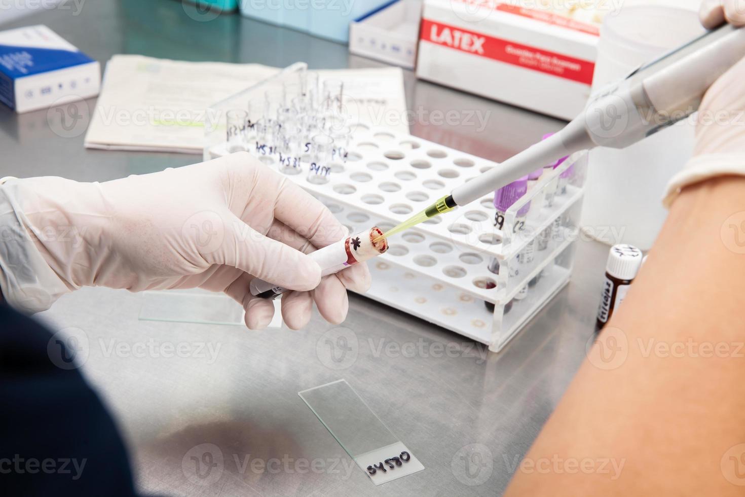 Scientist preparing samples for flow cytometric analysis in the laboratory. Cancer diagnosis photo