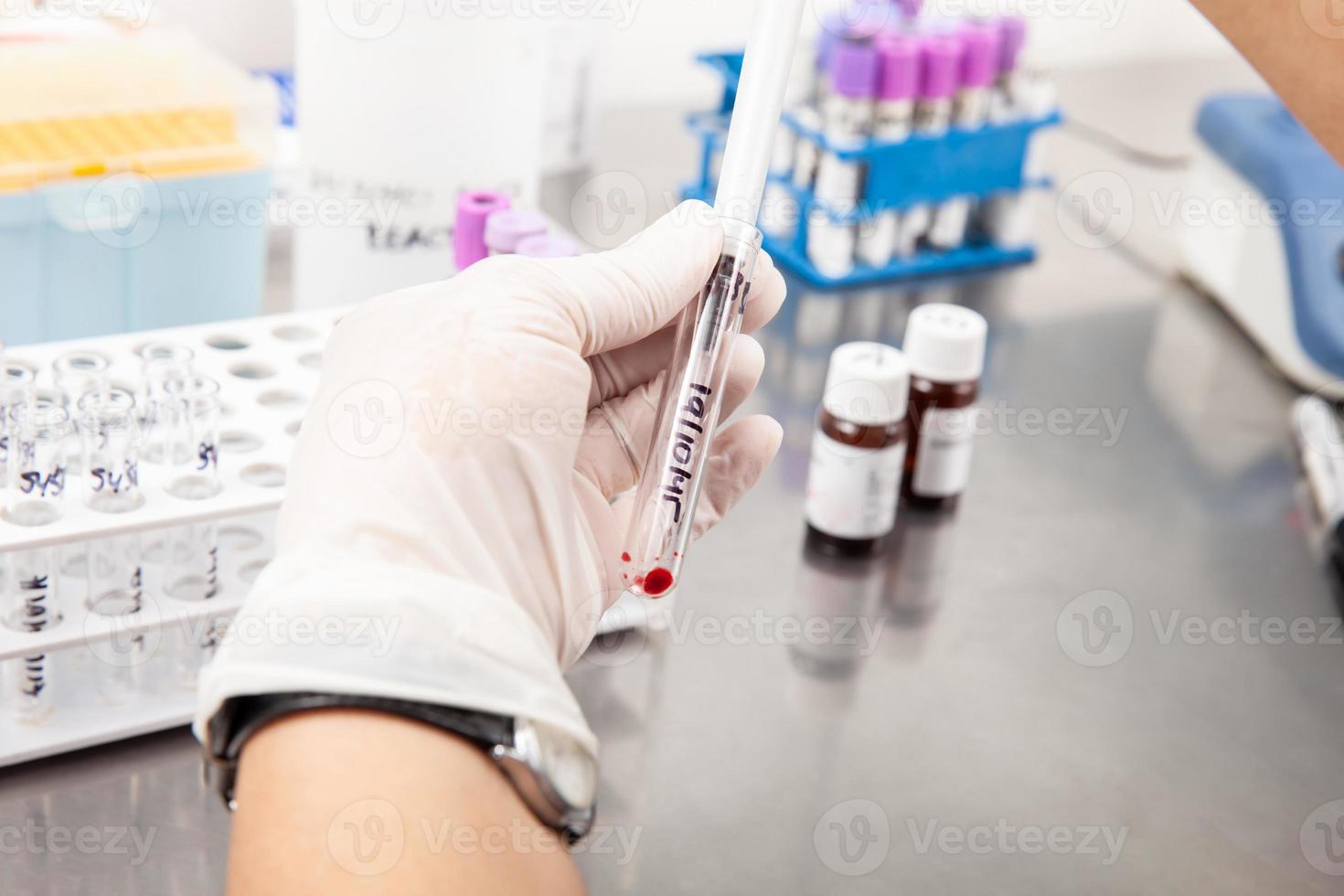 Scientist preparing bone marrow samples for flow cytometric analysis in the laboratory. photo