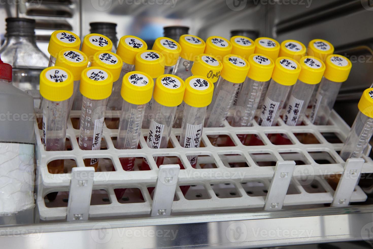 Test tubes with blood samples in the incubator during the process of preparation for karyotype and fluorescence in situ hybridization - FISH in the laboratory photo