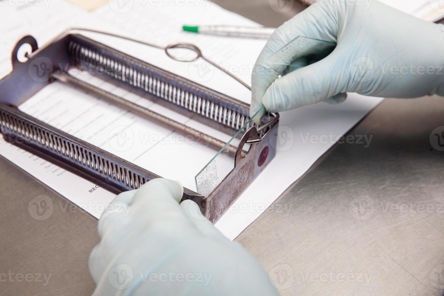 Laboratorian giving admission to pap smear samples in the laboratory for analysis. Scientist receiving patient samples for laboratory for analysis. Cervical cancer concept. Medical concept. photo