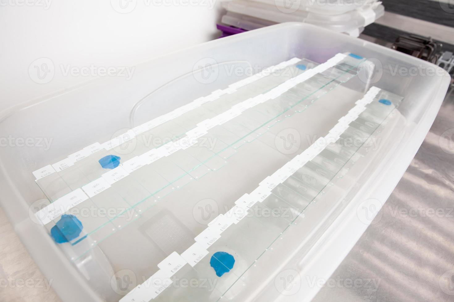 Scientist preparing slides with paraffin embedded tissue samples for immunohistochemistry assay in the laboratory. photo