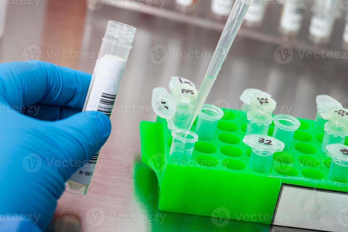 Closeup of a scientist extracting DNA using the spin column-based nucleic acid purification technique. Spin column-based nucleic acid purification technique. Diagnosis of human papillomavirus virus. photo