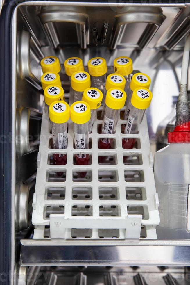 Test tubes with blood samples in the incubator during the process of preparation for karyotype and fluorescence in situ hybridization - FISH in the laboratory photo