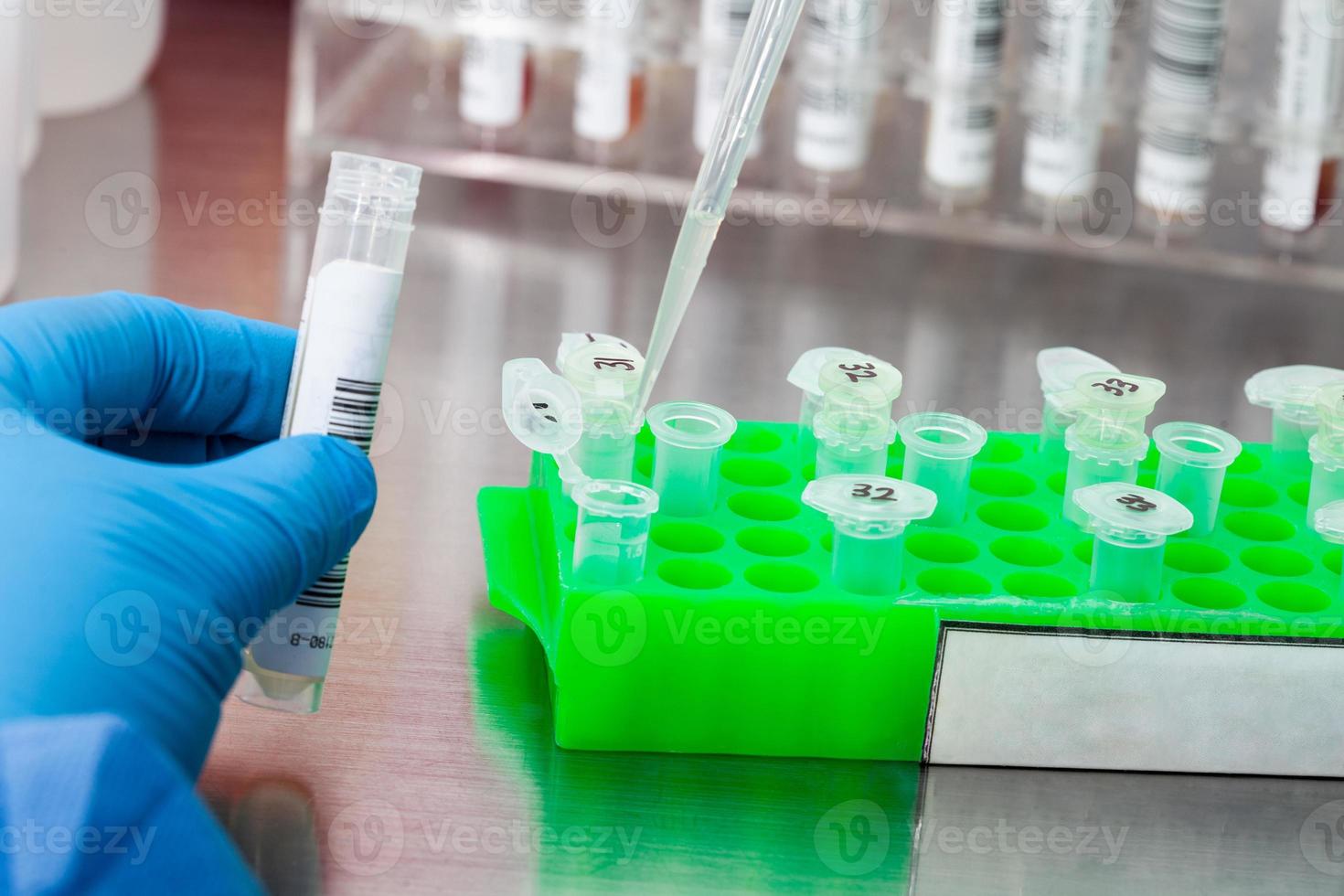 Closeup of a scientist extracting DNA using the spin column-based nucleic acid purification technique. Spin column-based nucleic acid purification technique. Diagnosis of human papillomavirus virus. photo
