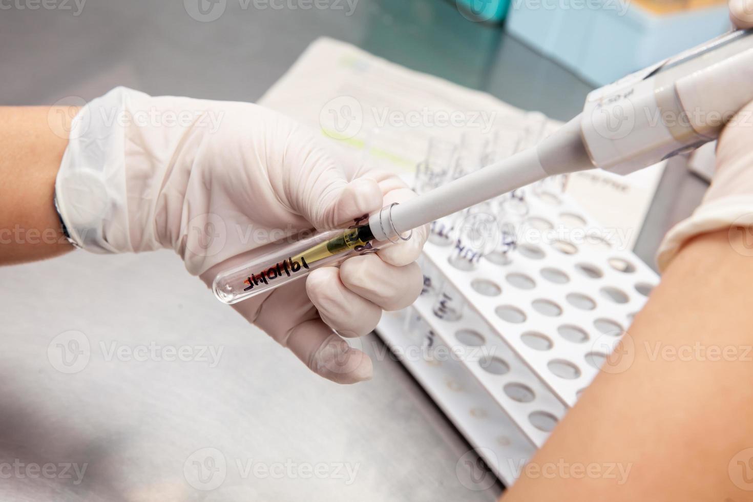 Scientist preparing samples for flow cytometric analysis in the laboratory. Cancer diagnosis photo