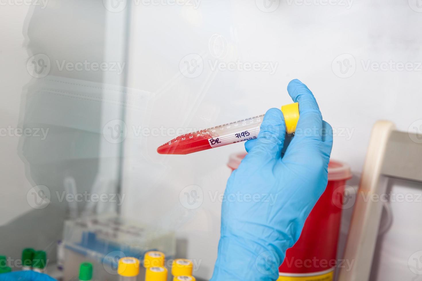 Scientist preparing blood samples for karyotipe and fluorescence in