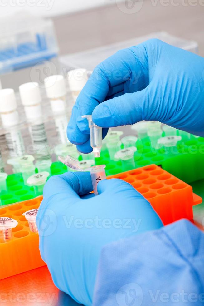 Closeup of scientist hands while extracting DNA using the spin column-based nucleic acid purification technique photo