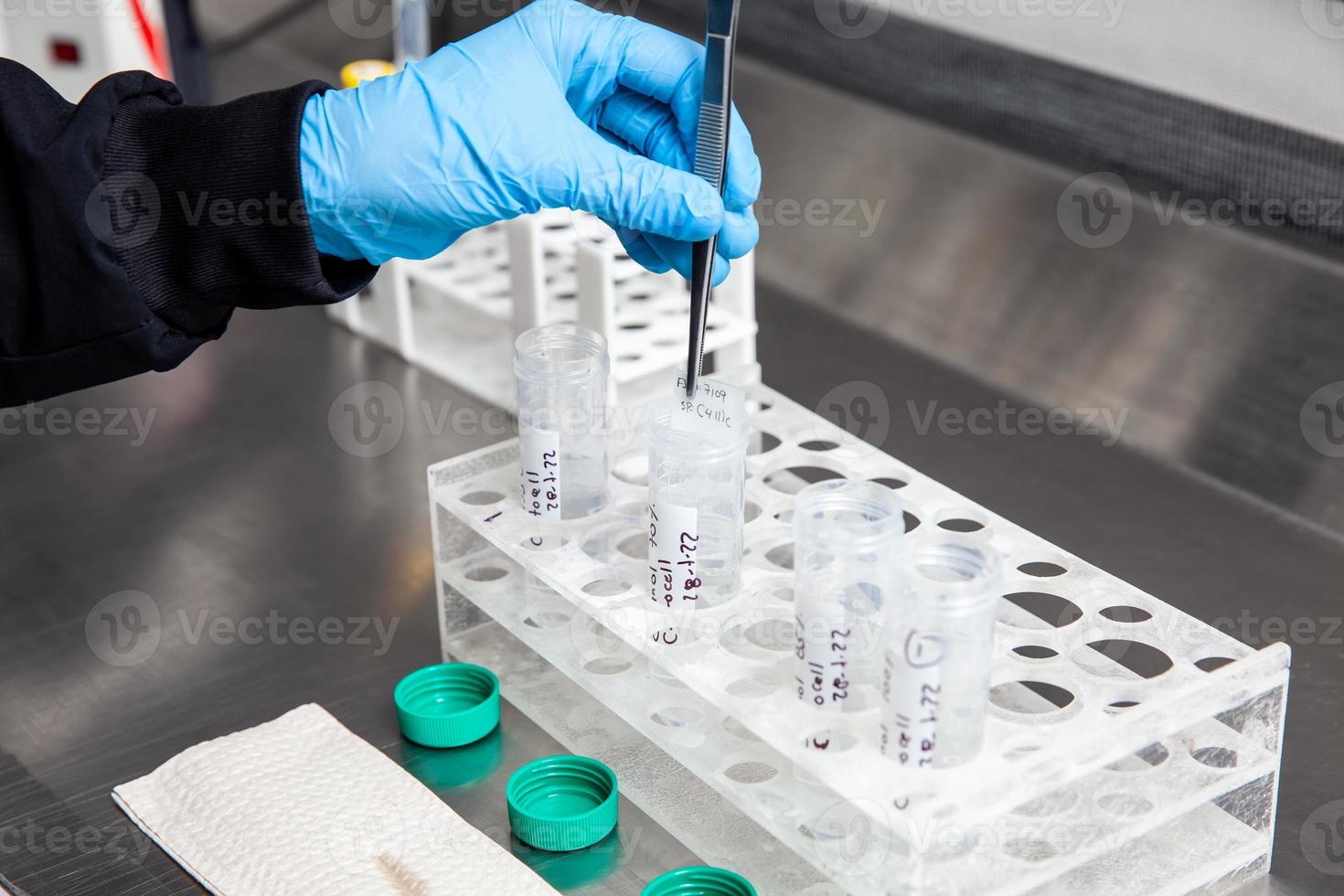 Scientist preparing slides for karyotipe and fluorescence in situ hybridization - FISH in the laboratory. Acute lymphocytic leukemia. Translocation 4 11. photo