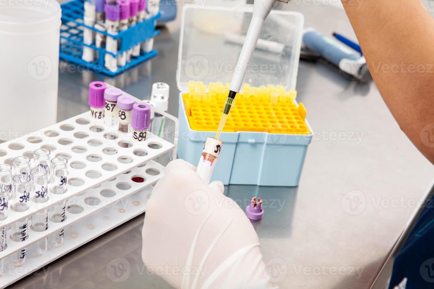 Scientist preparing bone marrow samples for flow cytometric analysis in the laboratory. photo