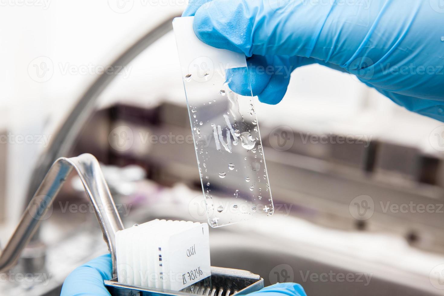 Scientist showing a dewaxed tissue samples in the laboratory. Xylene-based removal of paraffin. photo