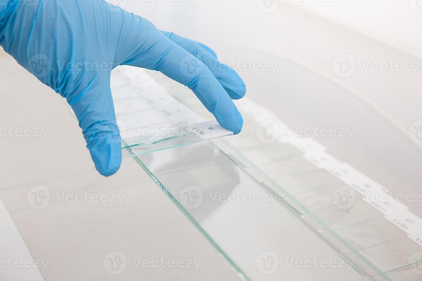 Scientist preparing slides with paraffin embedded tissue samples for immunohistochemistry assay in the laboratory. photo