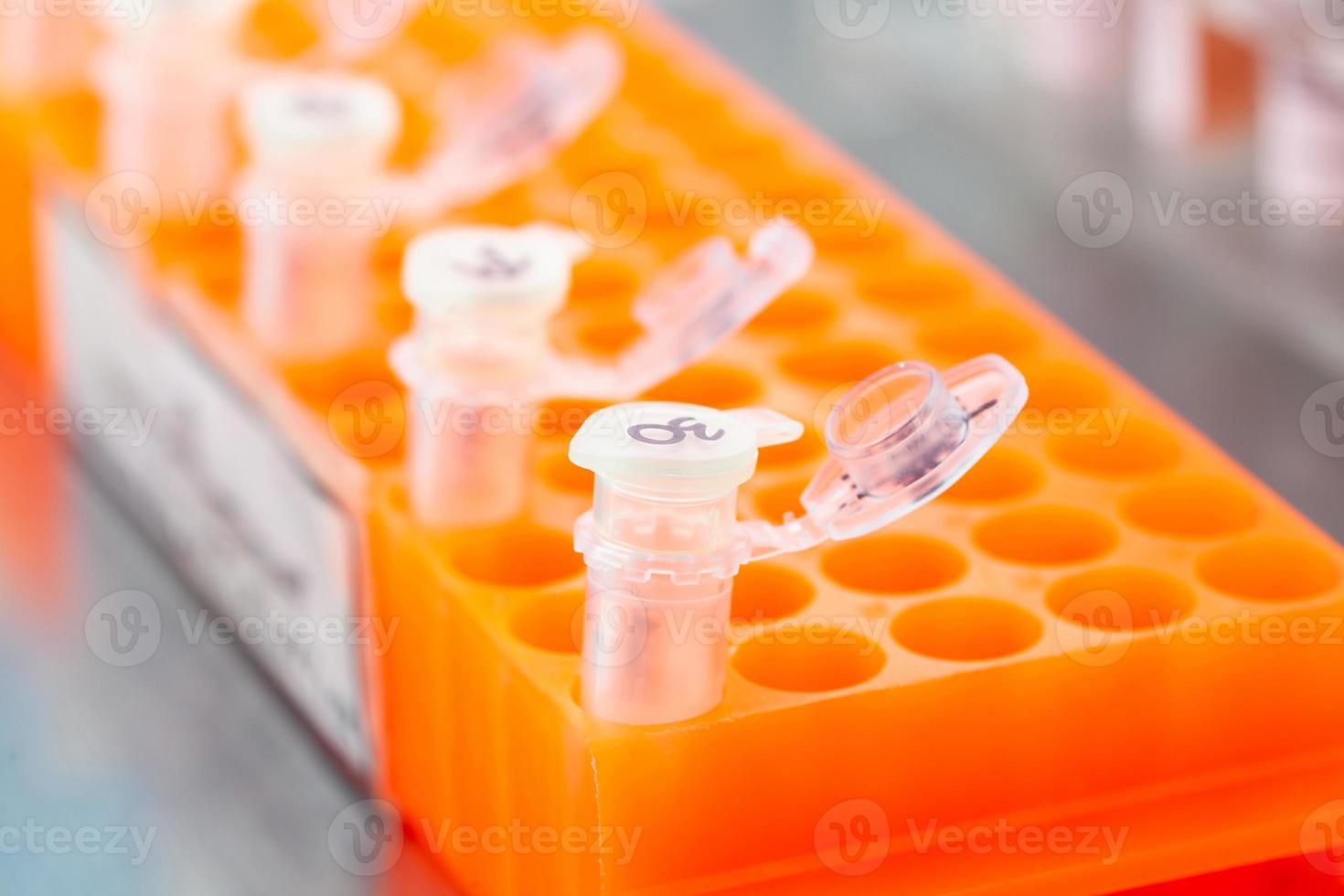 Rack of test tubes being used for DNA extraction using the spin column-based nucleic acid purification technique photo