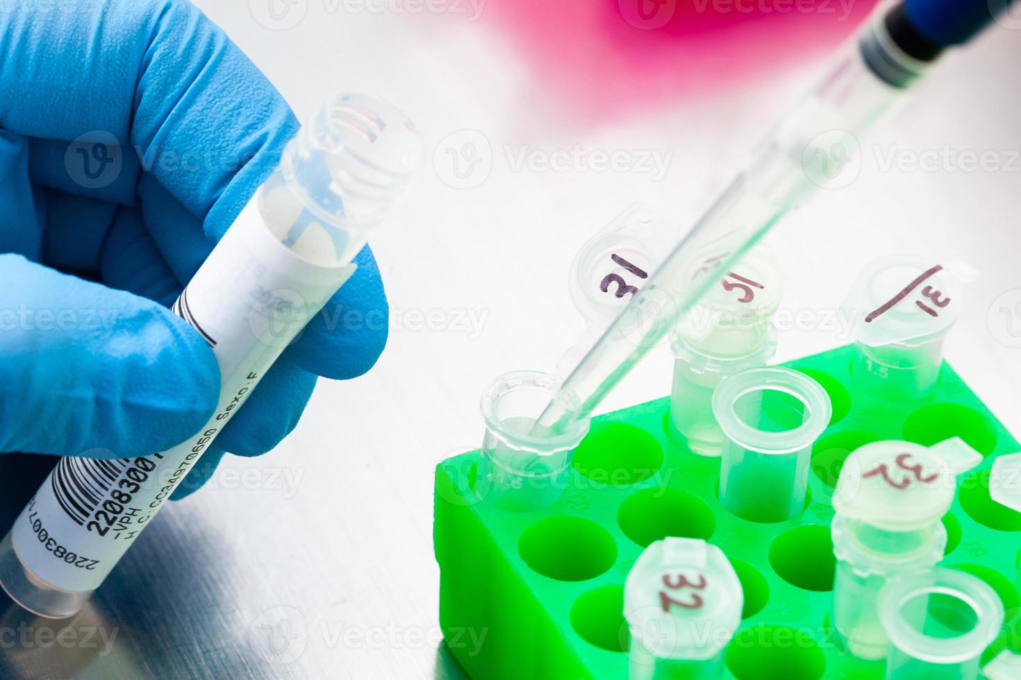 Closeup of a scientist extracting DNA using the spin column-based nucleic acid purification technique. Spin column-based nucleic acid purification technique. Diagnosis of human papillomavirus virus. photo