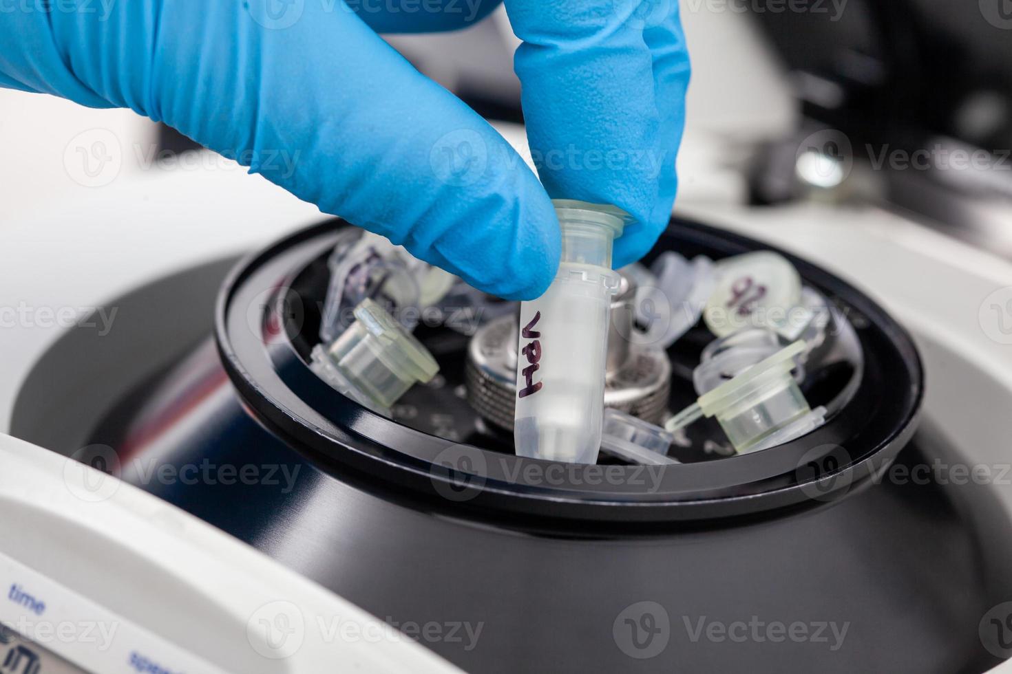 Closeup of a scientist hand placing a tube into an small table centrifuge. Spin column-based nucleic acid purification technique. Diagnosis of human papillomavirus virus infection. photo