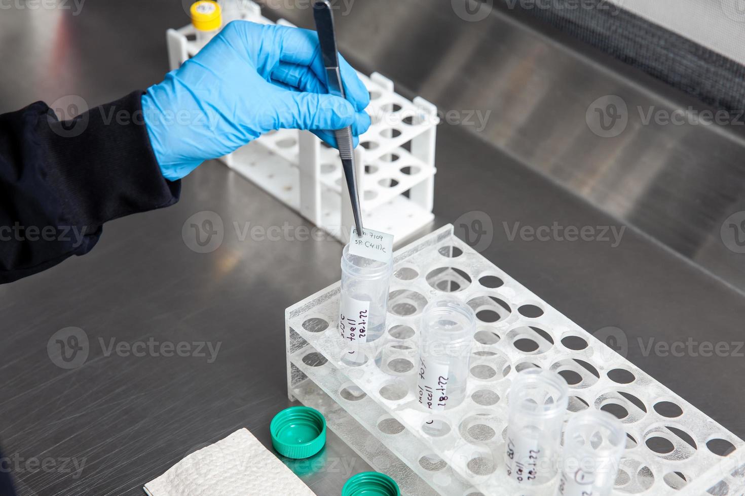 Scientist preparing slides for karyotipe and fluorescence in situ hybridization - FISH in the laboratory. Acute lymphocytic leukemia. Translocation 4 11. photo