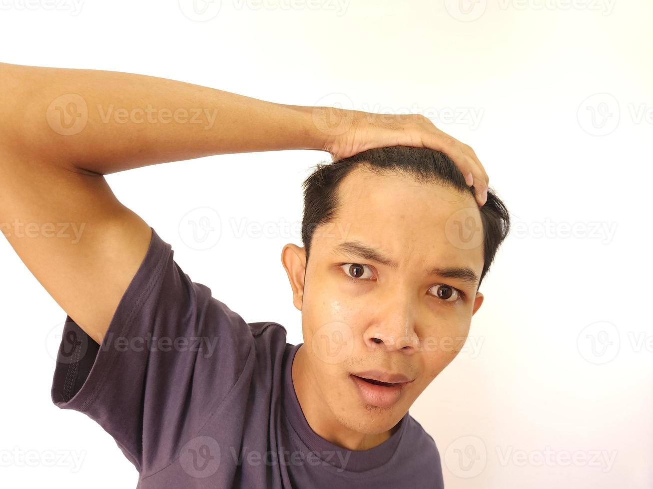 Shocked face of Asian man getting bald and lost hair in isolated white background photo