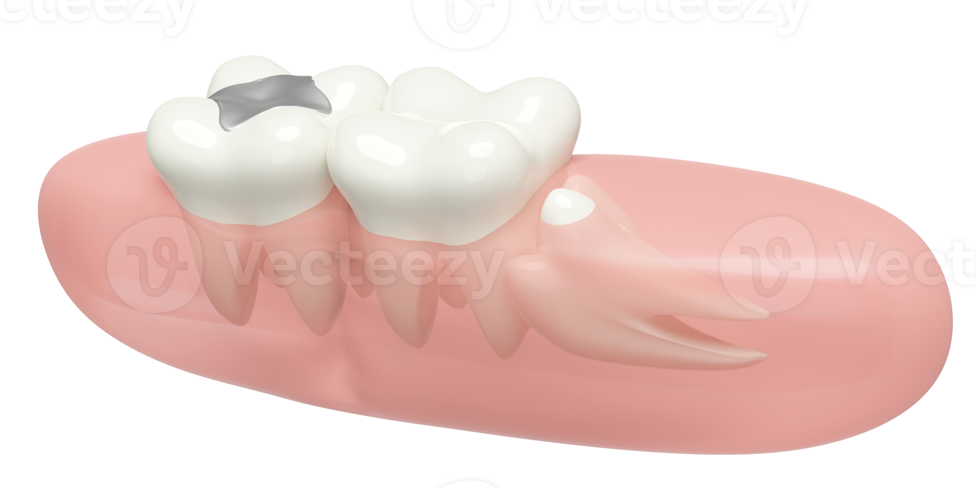 tandheelkundig examen van de tandarts, 3d wijsheid tanden model- problemen icoon met tandvlees geïsoleerd. Gezondheid van wit tanden, mondeling zorg, 3d geven illustratie png