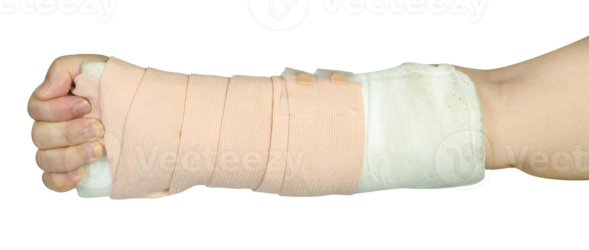 Hand making physical therapy to broken wrist from accident isolated png