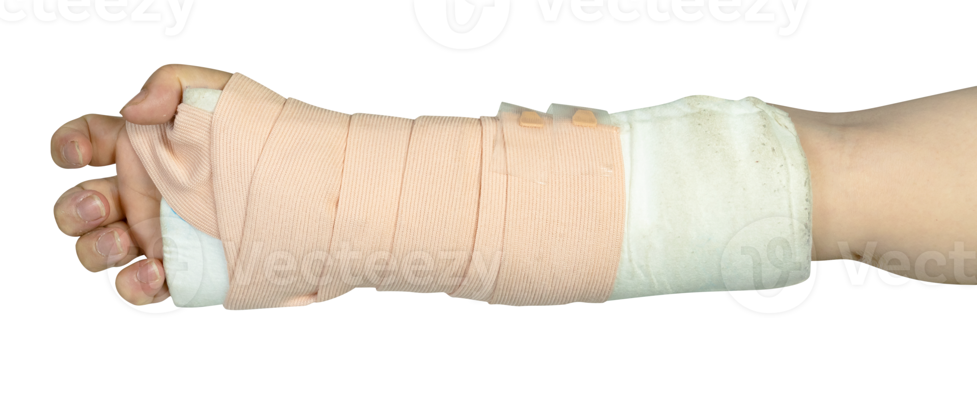 Hand making physical therapy to broken wrist from accident isolated png